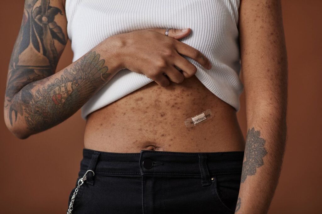 Aquaphor for Tattoos: Heal Ink Like a Pro