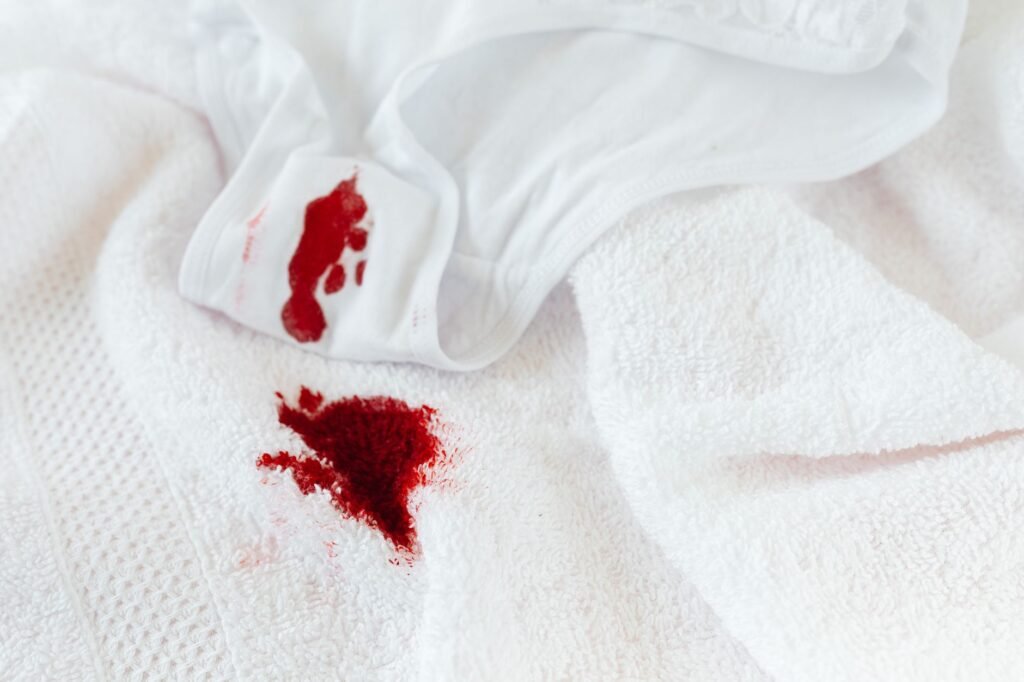 Can a Kidney Infection Stop Your Period? Unexpected Ties
