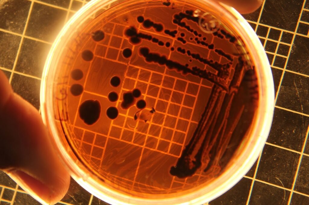 Can Kidney Stones Cause E. Coli Infection? Stone Risks