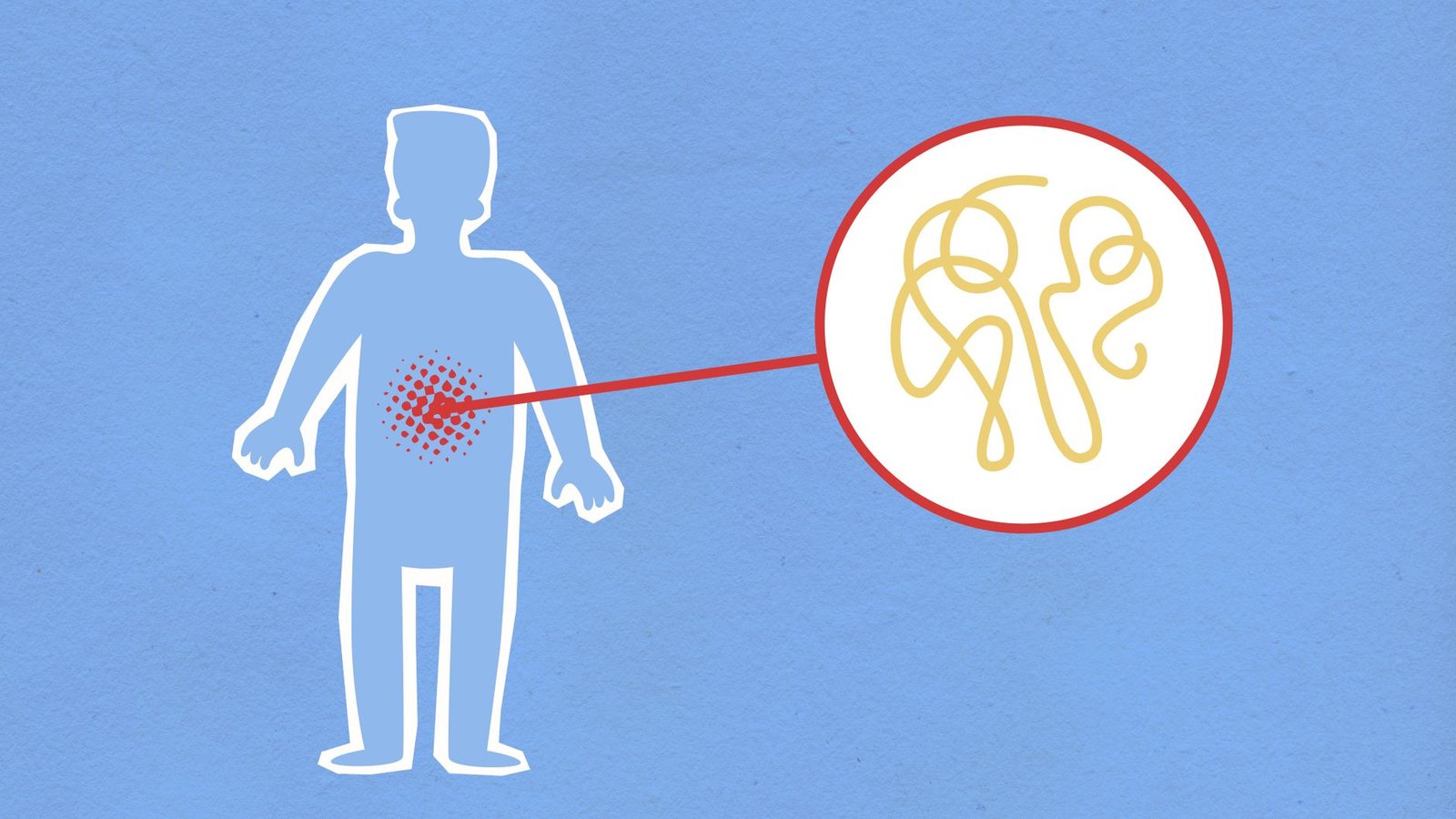 Does Kidney Infection Cause Bloating? Unpack the Pain