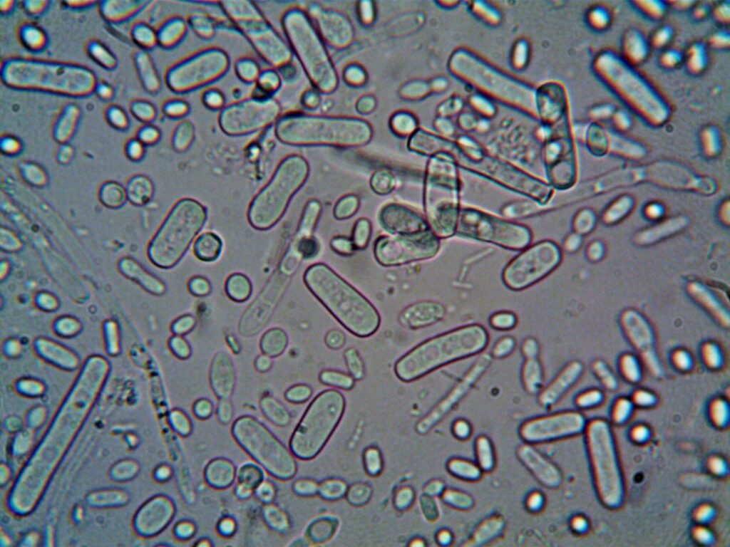 Enterococcus Kidney Infection: Bacterial Battles