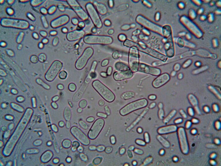 Enterococcus Kidney Infection: Bacterial Battles