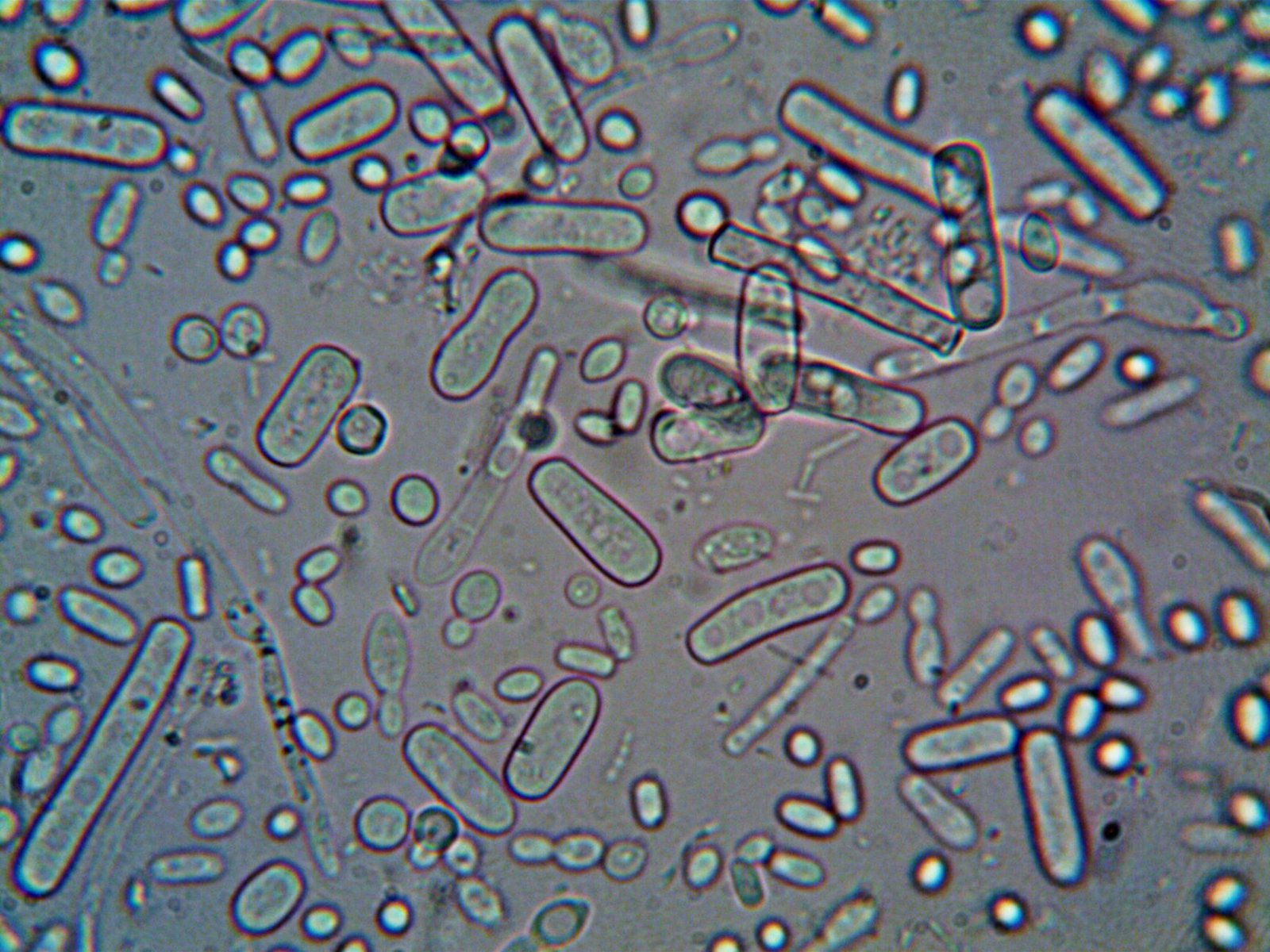 Enterococcus Kidney Infection: Bacterial Battles