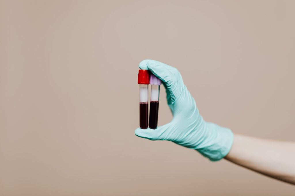 Kidney Infection Quiz: Test Your Know-how