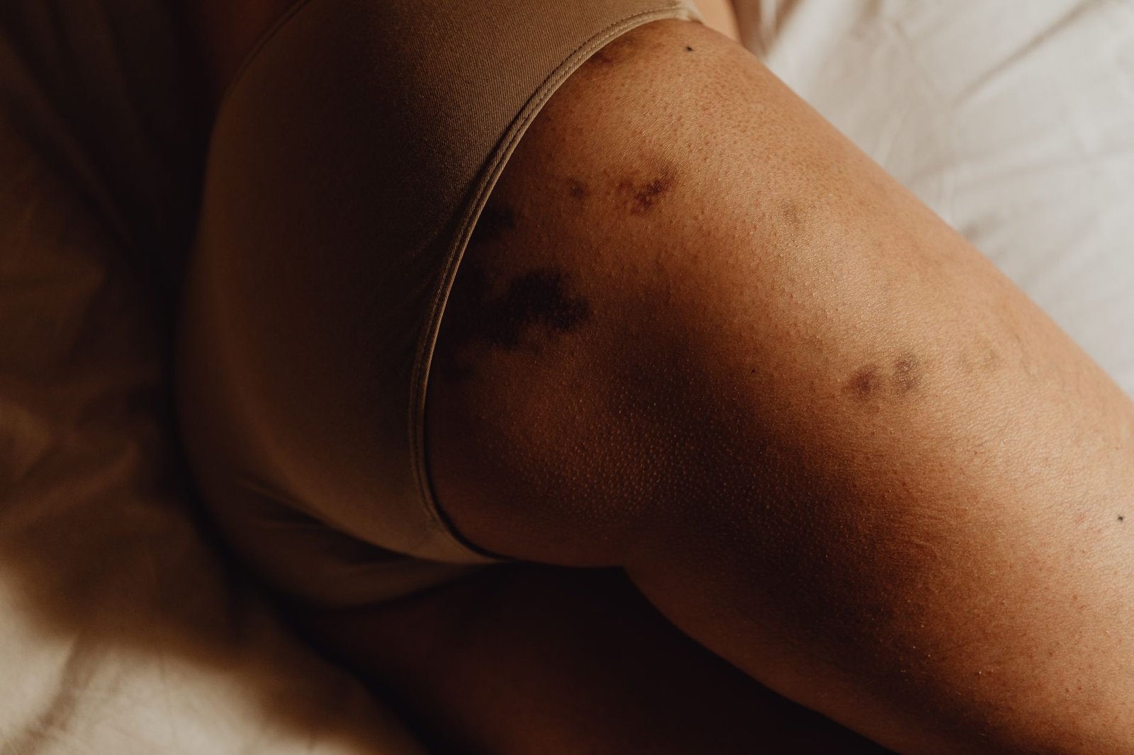 Kidney Infection Reddit: Real Stories, Raw Truths