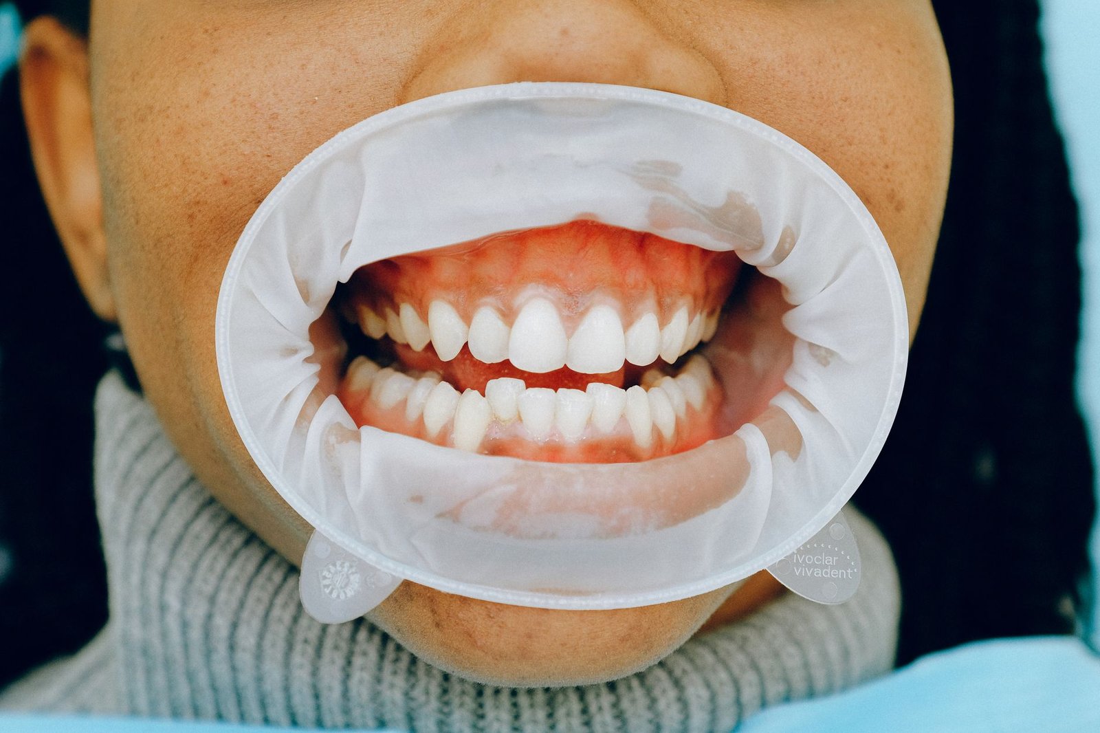 Pictures of Gum Boils: Spot Trouble Early