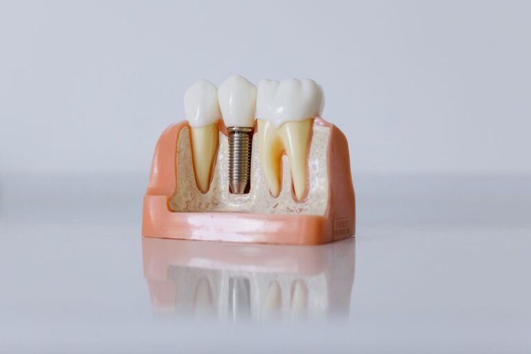 dental implant infection pictures