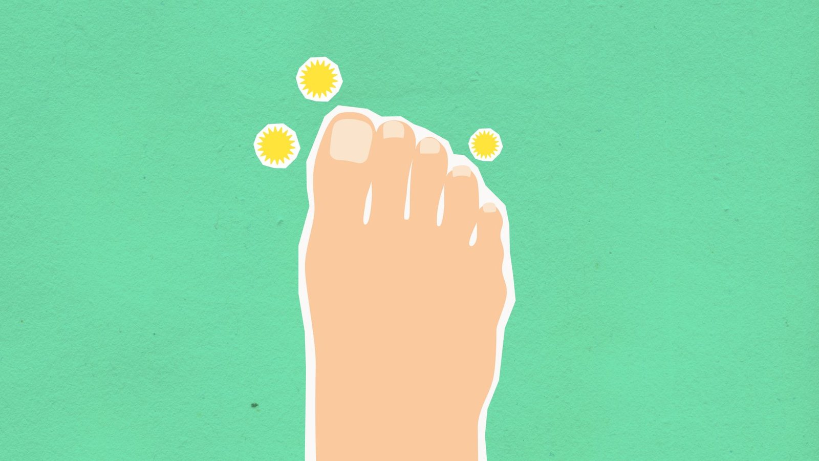 diabetic foot infection icd 10