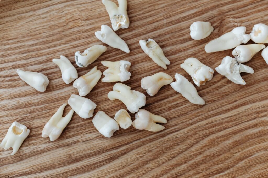 Root Canal Infection Years Later