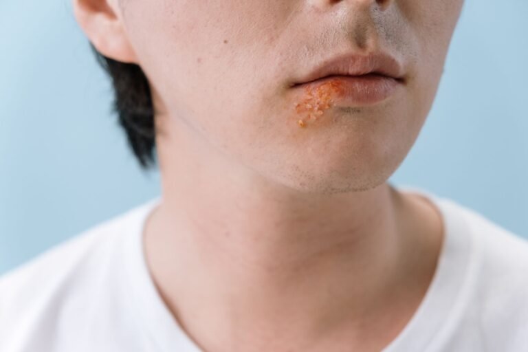 Staph Infection in Ear