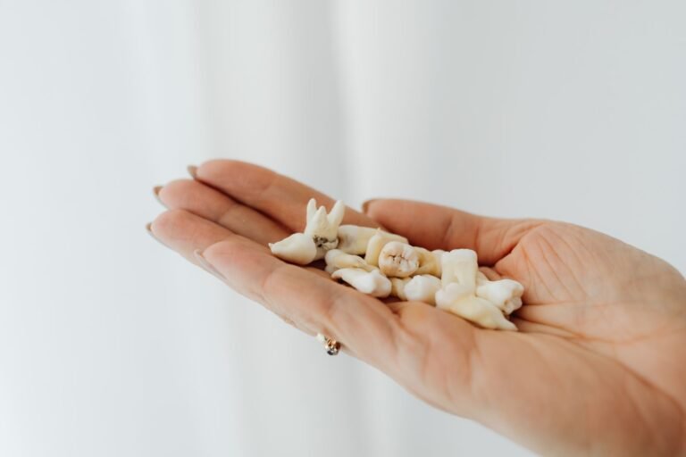 Wisdom Tooth Extraction Infection