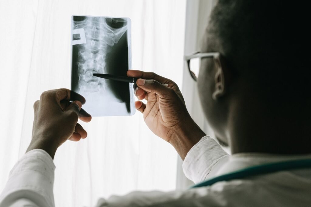 A clear illustration of the spinal column showing intervertebral discs