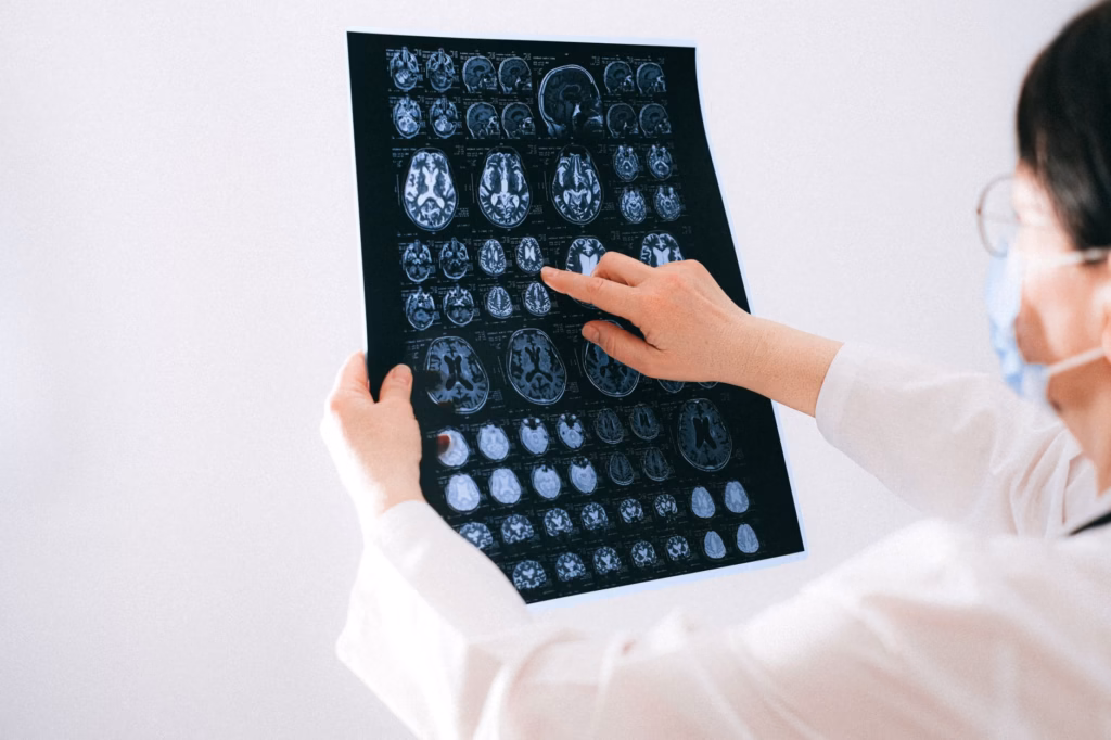 A physician examining spinal MRI images to look for inflammation