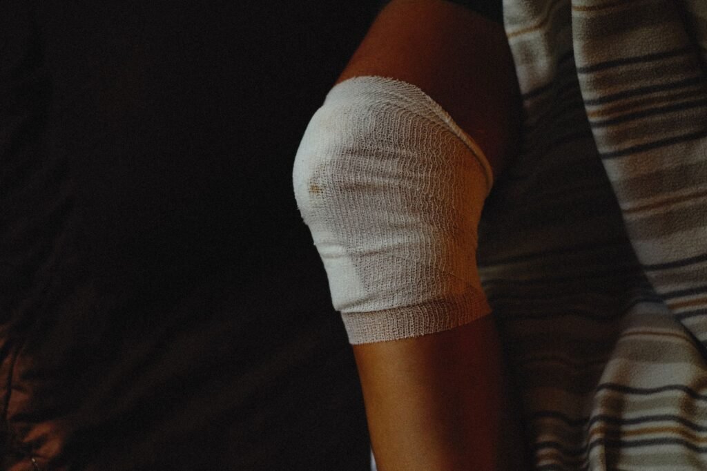 A swollen knee joint illustrating inflammation