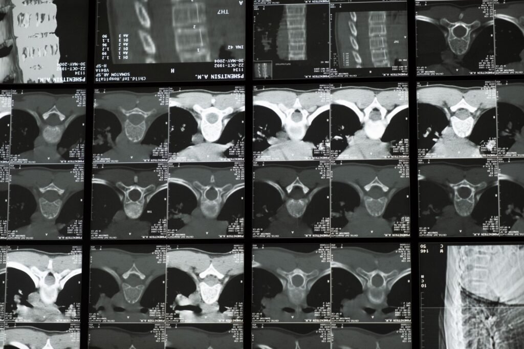 A technician performs a bone density scan on a patient lying on a table