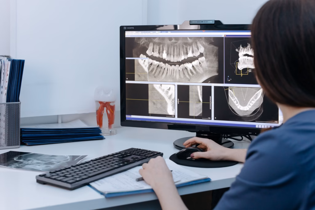 Dental X‑ray image used by clinicians to spot infections that may affect the sinuses