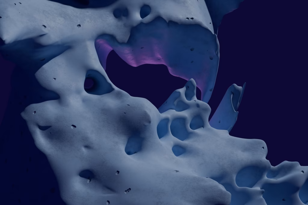 Diagram of the maxillary sinuses behind the cheekbones showing pressure source for jaw pain
