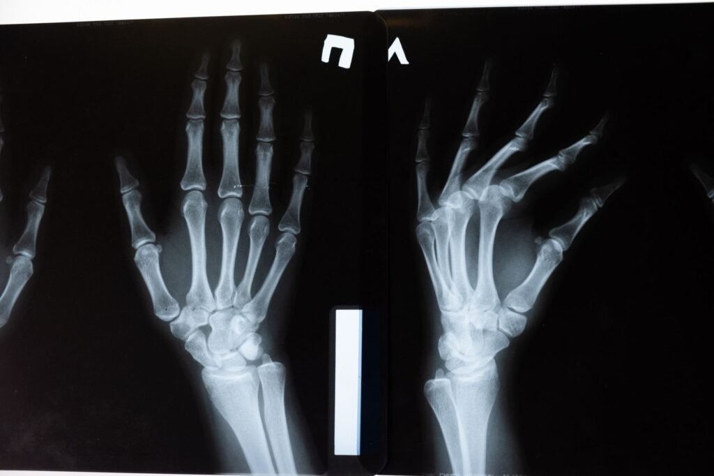 Bone density test