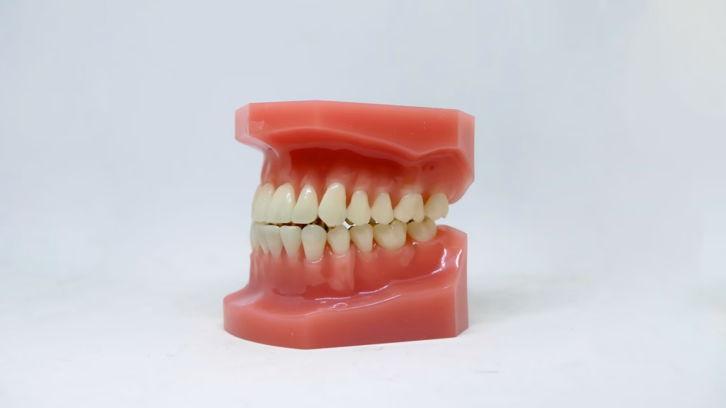 Illustration showing the close proximity of upper tooth roots to the maxillary sinus
